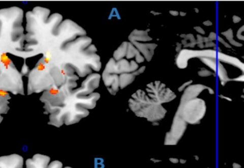 cambiamenti cerebrali anziani giovale