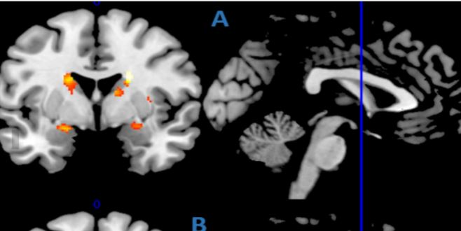 cambiamenti cerebrali anziani giovale